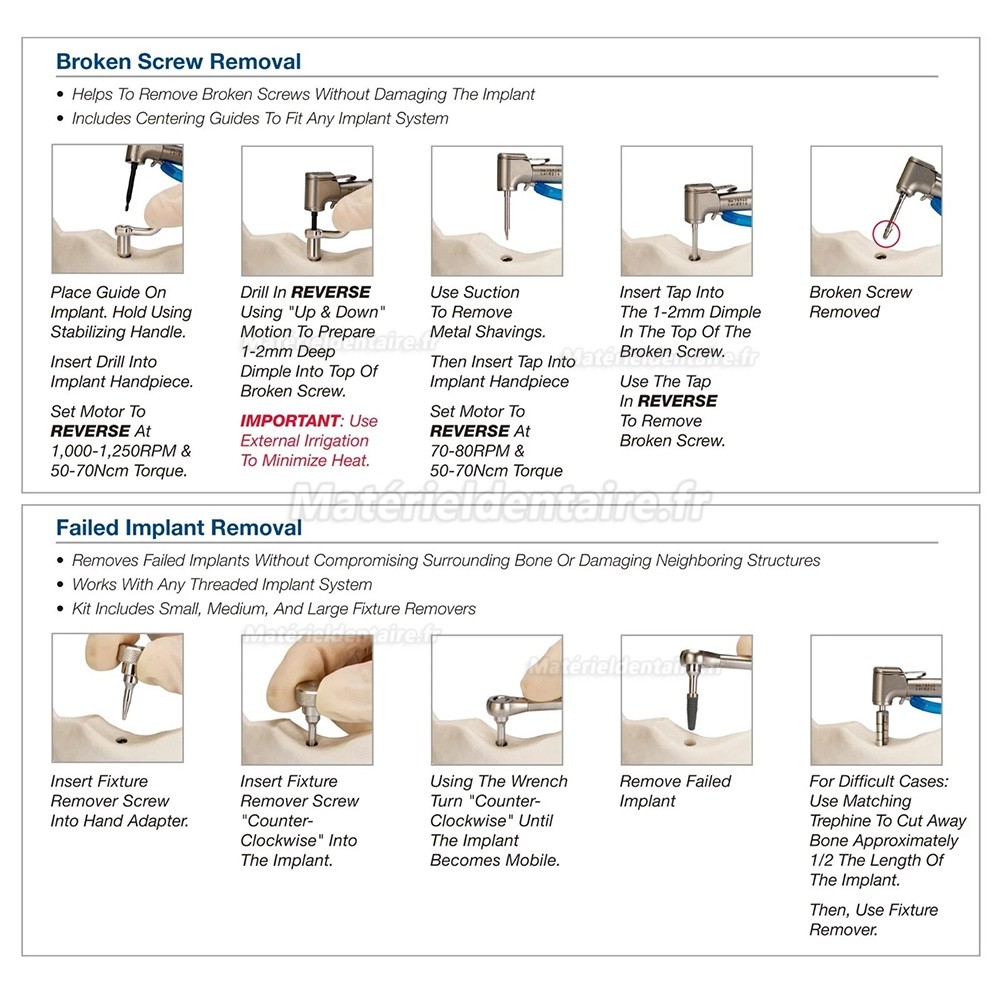Kit complet d'extraction implants et vis implantaires MCT FSRK-02 - Extracteur de guide de forage Kit complet d'extraction implants et vis implantaires MCT FSRK-02 - Extracteur de guide de forage